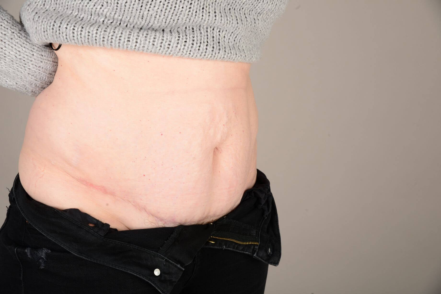 Tummy Tuck & Abdominoplasty