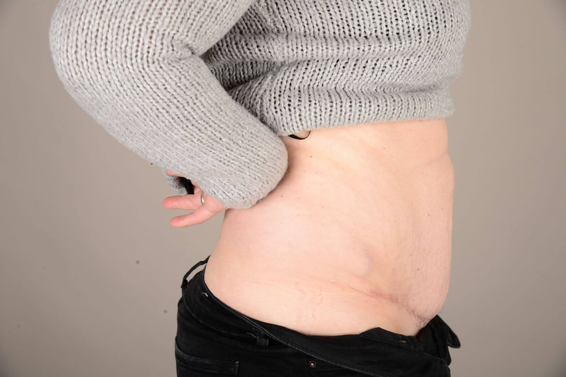 Tummy Tuck & Abdominoplasty Christian West